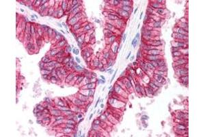 Immunohistochemistry (IHC) image for anti-ATP-Binding Cassette, Sub-Family C (CFTR/MRP), Member 4 (ABCC4) (C-Term) antibody (ABIN185302)