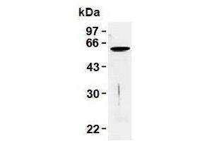 Western Blotting (WB) image for anti-Vimentin (VIM) antibody (ABIN1109486) (Vimentin Antikörper)