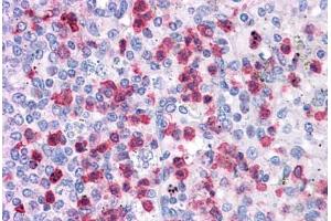 Immunohistochemistry (Formalin-fixed Paraffin-embedded Sections) (IHC (fp)) image for anti-Leucine Rich Repeat Containing 8 Family, Member B (LRRC8B) (AA 542-591) antibody (ABIN6745738)