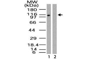 Western blot analysis of Importin-9 in HeLa lysate in the 1) absence and 2) presence of immunizing peptide. (Importin 9 Antikörper  (AA 950-1000))