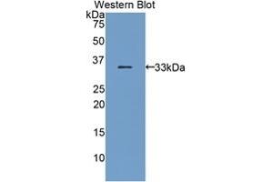 Detection of Recombinant BST1, Mouse using Polyclonal Antibody to Bone Marrow Stromal Cell Antigen 1 (BST1) (BST1 Antikörper  (AA 28-282))