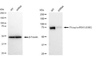 Western blotting analysis using Phospho-RSK1(S380) antibody (ABIN7800230).