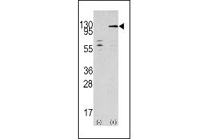 Western blot analysis of TAOK3 (arrow) using rabbit polyclonal TAOK3 Antibody (C-term) (ABIN390997 and ABIN2841175). (TAO Kinase 3 Antikörper  (C-Term))
