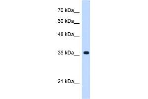 WB Suggested Anti-C19orf47 Antibody Titration:  0.