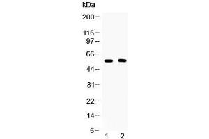 Western blot testing of human 1) placenta and 2) Jurkat lysate with CD147 antibody. (CD147 Antikörper)