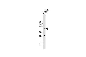 MMAA Antikörper  (N-Term)