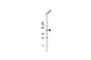Anti- Antibody (N-term) at 1:500 dilution + human liver lysate Lysates/proteins at 20 μg per lane.