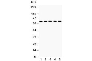Western blot testing of 12 Lipoxygenase antibody and Lane 1:  A549 (12-Lipoxygenase Antikörper  (C-Term))