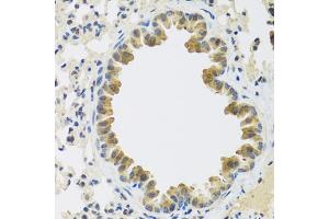 Immunohistochemistry of paraffin-embedded mouse lung using CRTAP antibody (ABIN5972488) at dilution of 1/100 (40x lens). (CRTAP Antikörper)