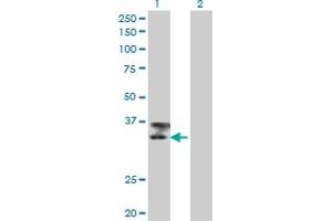 Western Blotting (WB) image for anti-Titin (TTN) (AA 1-111) antibody (ABIN598991) (Titin Antikörper  (AA 1-111))