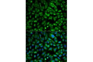 Immunofluorescence analysis of MCF7 cells using eIF4E antibody . (EIF4E Antikörper  (AA 1-217))