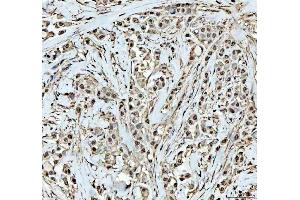 IHC analysis of DCK using anti-DCK antibody (ABIN5693016). (DCK Antikörper  (AA 17-260))