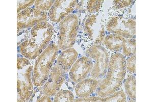 Immunohistochemistry of paraffin-embedded Rat kidney using MMP10 Polyclonal Antibody at dilution of 1:100 (40x lens).