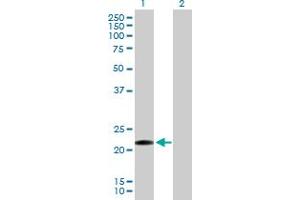 Western Blot analysis of CLEC1B expression in transfected 293T cell line by CLEC1B MaxPab polyclonal antibody. (C-Type Lectin Domain Family 1, Member B (CLEC1B) (AA 1-196) Antikörper)
