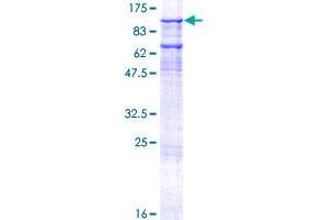 Image no. 1 for General Transcription Factor IIIC, Polypeptide 3, 102kDa (GTF3C3) (AA 1-886) protein (GST tag) (ABIN1306171) (GTF3C3 Protein (AA 1-886) (GST tag))