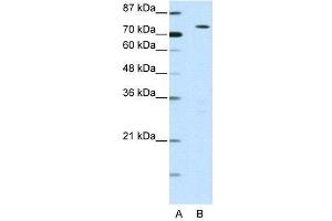 WB Suggested Anti-MYST2  Antibody Titration: 0. (MYST2 Antikörper  (N-Term))