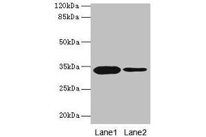 Western blot All lanes: OGN antibody at 14 μg/mL Lane 1: Rat liver tissue Lane 2: 293T whole cell lysate Secondary Goat polyclonal to rabbit IgG at 1/10000 dilution Predicted band size: 34 kDa Observed band size: 34 kDa (OGN Antikörper  (AA 21-298))