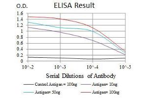 Black line: Control Antigen (100 ng), Purple line: Antigen(10 ng), Blue line: Antigen (50 ng), Red line: Antigen (100 ng), (CYP1A1 Antikörper)