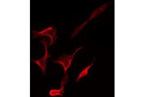 ABIN6267269 staining SK-OV3 by IF/ICC. (EGFR Antikörper  (pSer1071))