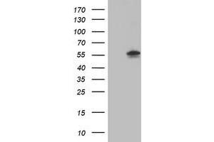 HEK293T cells were transfected with the pCMV6-ENTRY control (Left lane) or pCMV6-ENTRY AKT1 (Right lane) cDNA for 48 hrs and lysed. (AKT1 Antikörper)