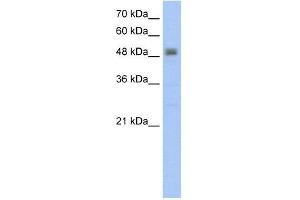 RSAD2 antibody used at 5 ug/ml to detect target protein. (RSAD2 Antikörper  (C-Term))