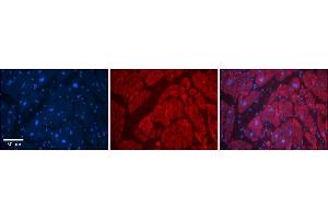 Rabbit Anti-SLC6A5 Antibody    Formalin Fixed Paraffin Embedded Tissue: Human Adult heart  Observed Staining: Cytoplasmic Primary Antibody Concentration: 1:600 Secondary Antibody: Donkey anti-Rabbit-Cy2/3 Secondary Antibody Concentration: 1:200 Magnification: 20X Exposure Time: 0. (SLC6A5 Antikörper  (N-Term))