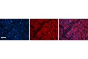 Immunohistochemistry (IHC) image for anti-Solute Carrier Family 6 (Neurotransmitter Transporter, Glycine), Member 5 (SLC6A5) (N-Term) antibody (ABIN2781602)