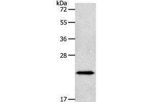Western Blot analysis of Human liver cancer tissue using NEUROG1 Polyclonal Antibody at dilution of 1:400 (Neurogenin 1 Antikörper)