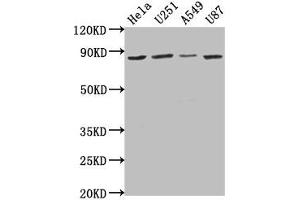 Western Blot Positive WB detected in: Hela whole cell lysate, U251 whole cell lysate, A549 whole cell lysate, U87 whole cell lysate All lanes: VPS51 antibody at 1:1000 Secondary Goat polyclonal to rabbit IgG at 1/50000 dilution Predicted band size: 87, 73 kDa Observed band size: 87 kDa (VPS51 Antikörper  (AA 595-673))