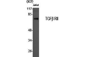 Western Blot analysis of Jurkat cells using TGF β Receptor II Polyclonal Antibody at dilution of 1:2000. (TGFBR2 Antikörper)