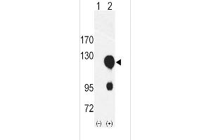 Western blot analysis of ROR2 using rabbit polyclonal ROR2 Antibody using 293 cell lysates (2 ug/lane) either nontransfected (Lane 1) or transiently transfected with the ROR2 gene (Lane 2). (ROR2 Antikörper  (N-Term))
