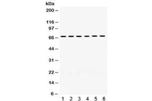 Western blot testing of 1) rat liver, 2) rat lung, 3) mouse liver, 4) mouse lung, 5) human COLO320 and 6) human MCF7 lysate with PDPK1 antibody. (PDPK1 Antikörper)
