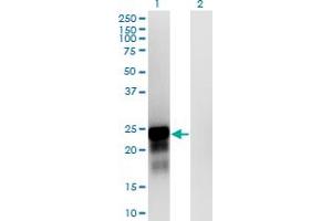 Western Blot analysis of SPANXN3 expression in transfected 293T cell line by SPANXN3 monoclonal antibody (M01), clone 1F11. (SPANXN3 Antikörper  (AA 1-141))