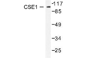 Image no. 2 for anti-CSE1 Chromosome Segregation 1-Like (CSE1L) antibody (ABIN265374) (Exportin 2 Antikörper)