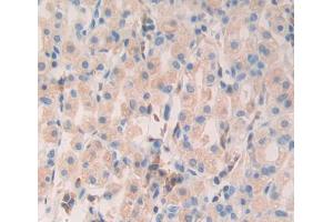 Used in DAB staining on fromalin fixed paraffin- embedded Kidney tissue (MYL6B Antikörper  (AA 5-199))