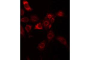 ABIN6274904 staining HuvEc by IF/ICC. (B3GALT1 Antikörper  (N-Term))