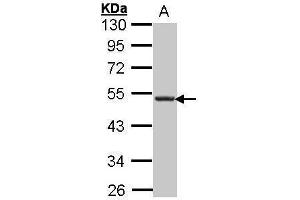 WB Image Sample (30 ug of whole cell lysate) A: Hep G2 , 10% SDS PAGE antibody diluted at 1:1000 (CXCR5 Antikörper)
