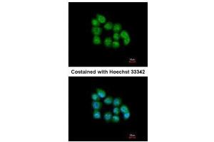 ICC/IF Image Immunofluorescence analysis of paraformaldehyde-fixed A431, using MBNL3, antibody at 1:200 dilution. (MBNL3 Antikörper)