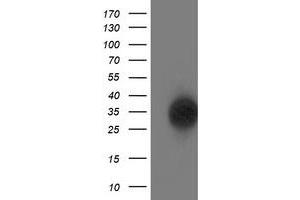 Western Blotting (WB) image for anti-Suppressor of Cytokine Signaling 3 (SOCS3) antibody (ABIN1501056)