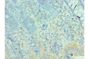 Immunohistochemistry of paraffin-embedded human epityphlon tissue using ABIN7160627 at dilution of 1:100 (MTM1 Antikörper  (AA 484-603))