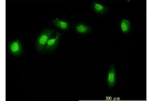 Immunofluorescence of monoclonal antibody to WDR61 on HeLa cell. (WDR61 Antikörper  (AA 1-305))