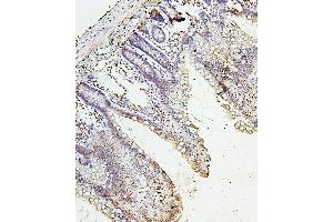 IHC analysis of H1F0 using anti-H1F0 antibody (ABIN7600521). (Histone H1 Antikörper  (AA 20-159))