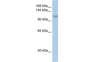 Western Blotting (WB) image for anti-PRP6 Pre-mRNA Processing Factor 6 Homolog (PRPF6) antibody (ABIN2462244) (PRP6/ANT-1 Antikörper)
