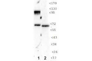 Image no. 1 for anti-Hypoxia Inducible Factor 1, alpha Subunit (Basic Helix-Loop-Helix Transcription Factor) (HIF1A) (AA 432-528) antibody (ABIN363216) (HIF1A Antikörper  (AA 432-528))
