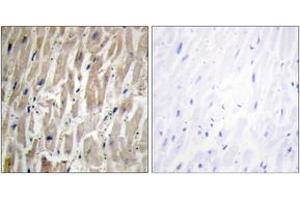 Immunohistochemistry (Paraffin-embedded Sections) (IHC (p)) image for anti-Cytochrome P450, Family 2, Subfamily J, Polypeptide 2 (CYP2J2) (AA 231-280) antibody (ABIN2889947) (CYP2J2 Antikörper  (AA 231-280))