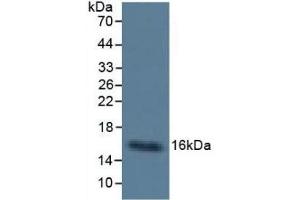 Mouse Capture antibody from the kit in WB with Positive Control: Sample Human Urine.