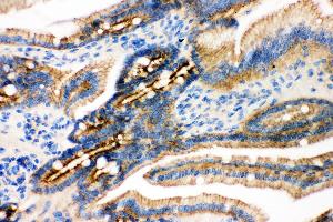 Anti- gamma Catenin Picoband antibody, IHC(P) IHC(P): Mouse Intestine Tissue (JUP Antikörper  (AA 556-745))