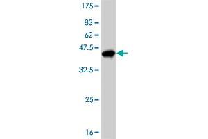 Western Blot detection against Immunogen (35. (MECP2 Antikörper  (AA 81-170))