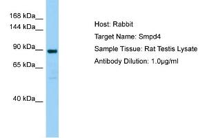WB Suggested Anti-Smpd4 Antibody   Titration: 1.