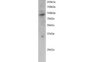 ABIN184622 staining (2µg/ml) of Jurkat lysate (RIPA buffer, 30µg total protein per lane). (PRAM1 Antikörper  (C-Term))